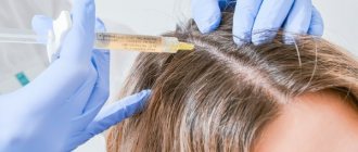Дермахил для волос в мезотерапии. Состав, фото до и после, инструкция применения