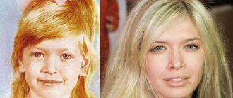Photos of V. Brezhneva before and after plastic surgery
