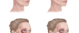 How does cheekbone contouring work?