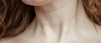 Venus rings on the neck. What do they mean, how to remove, reasons, photos 