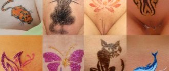 Laser Brazilian hair removal of the bikini area video