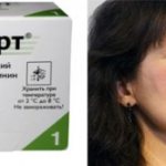 Dysport beauty injections, how much they cost and contraindications