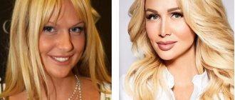 In her youth, Vika Lopyreva had a far from aristocratic nose, the shape of which was corrected during rhinoplasty